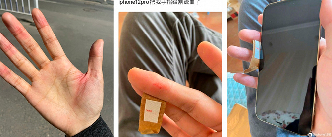 Владельцы iPhone 12 пожаловались на порезы от нового корпуса (фото 1)