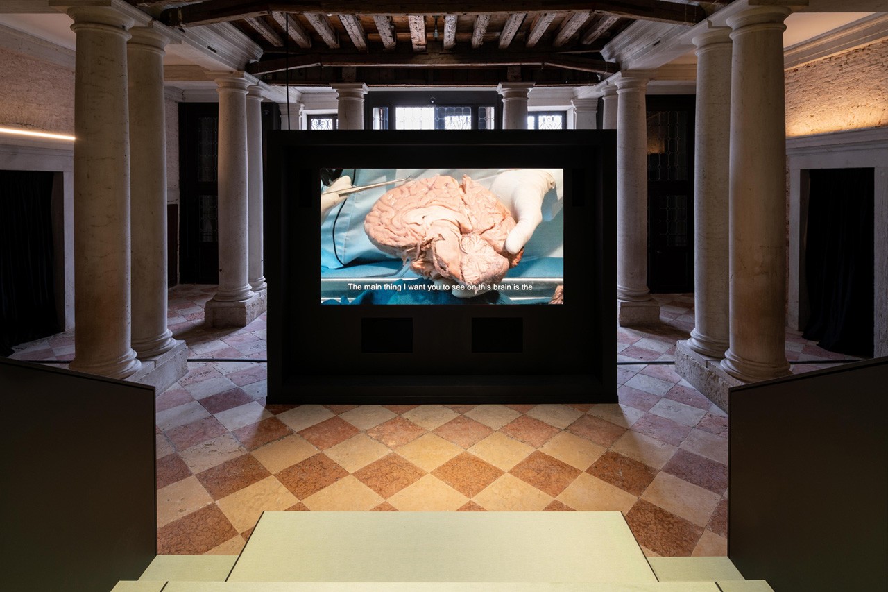 В Fondazione Prada открылась выставка, посвященная работе человеческого мозга (фото 3)