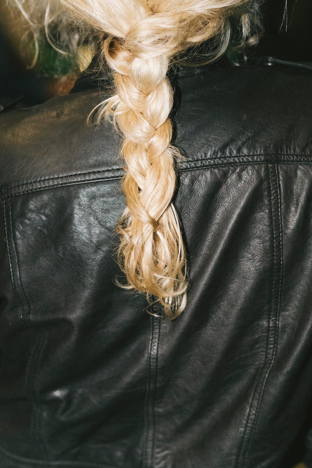 Андрогенная алопеция: что нужно знать и как остановить выпадение волос (фото 7)