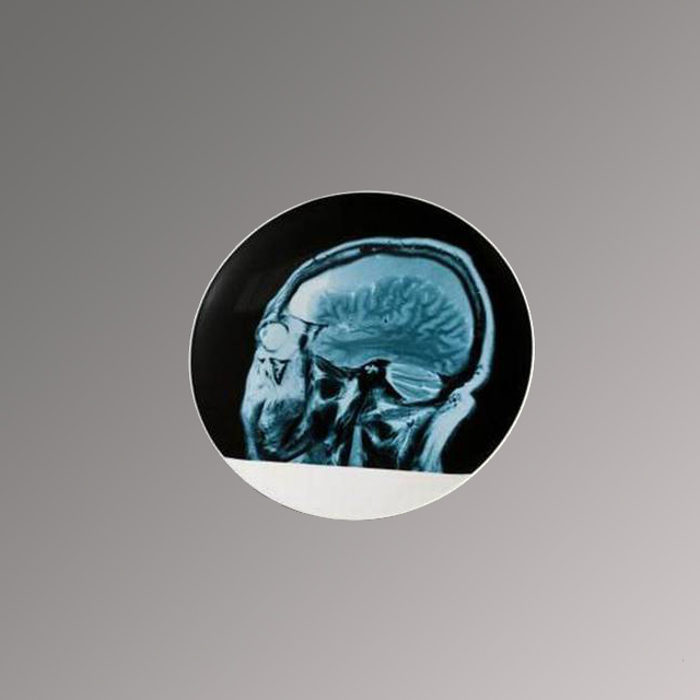 Ai WeiWei Hon RA, Brain Scan Image on Plate (1 set), 2012