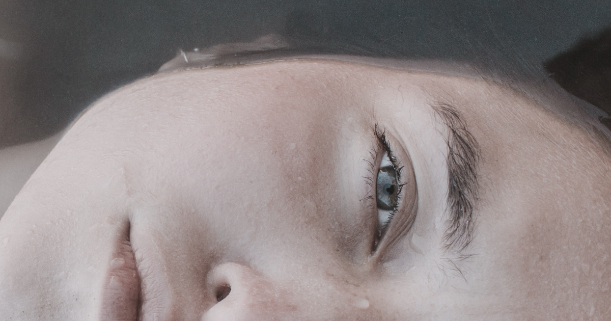 Что такое скин айсинг?