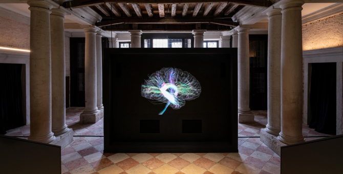 В Fondazione Prada открылась выставка, посвященная работе человеческого мозга