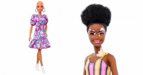Mattel выпустила кукол Барби с витилиго и алопецией